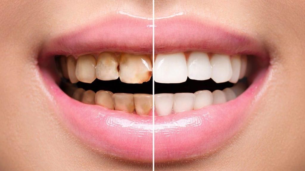 دندانپزشکی طرح لبخند|خدمات آرایشگری و زیبایی|قم, زنبیل آباد|دیوار