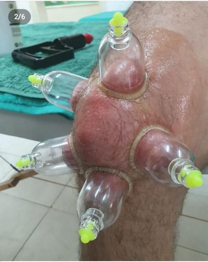 حجامت وبادکش|خدمات آرایشگری و زیبایی|ماهدشت, |دیوار