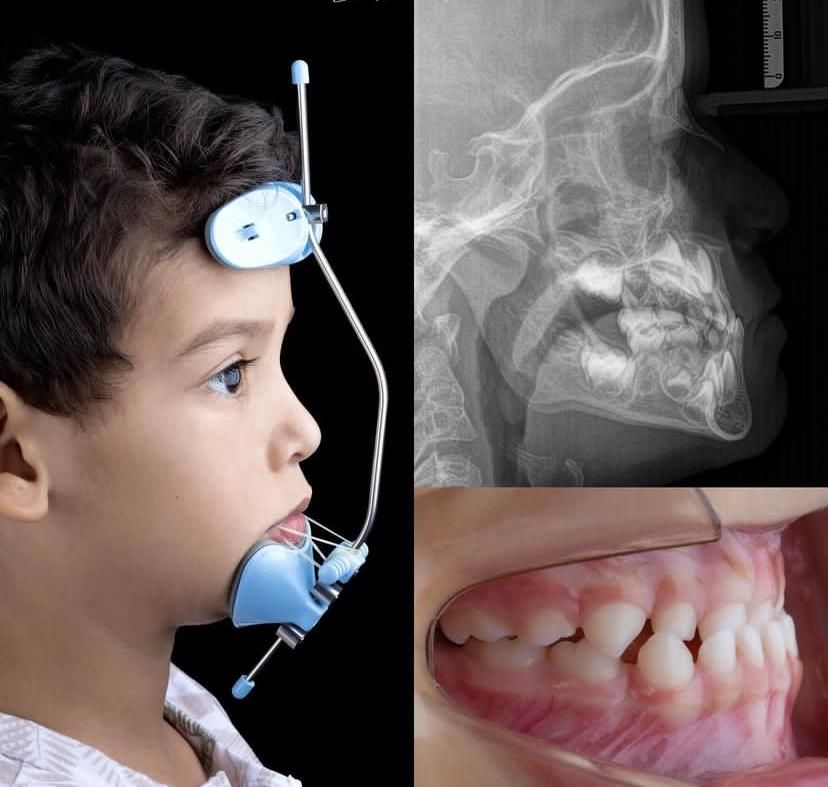ارتودنسی تخصصی کلینیک دکتر دانشور|خدمات آرایشگری و زیبایی|شیراز, معالی‌آباد|دیوار