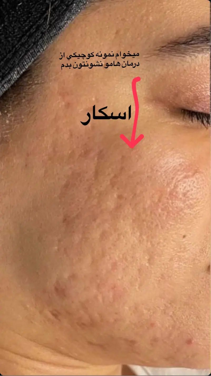 درمان تخصصی ،فیشال و اسیدتراپی و ماساژ درمانی صورت|خدمات آرایشگری و زیبایی|شیراز, رحمت‌آباد|دیوار