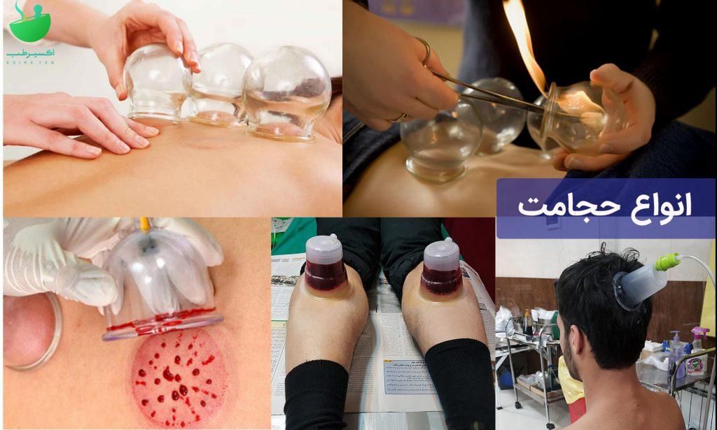 حجامت زالو درمانی طیب|خدمات آرایشگری و زیبایی|اسلام‌شهر, شهرک سالور|دیوار