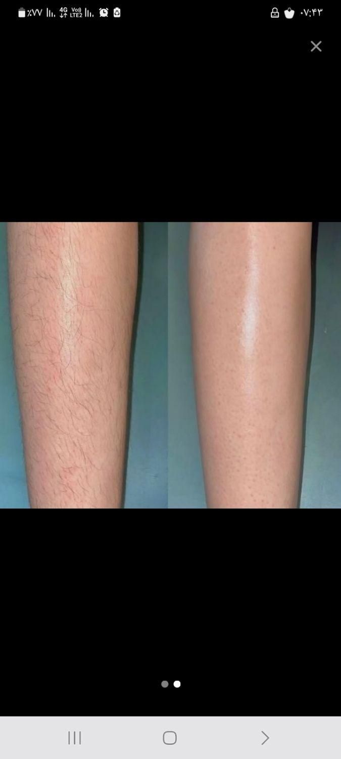 خدمات اپلاسیون|خدمات آرایشگری و زیبایی|نیشابور, شهرک اندیشه|دیوار