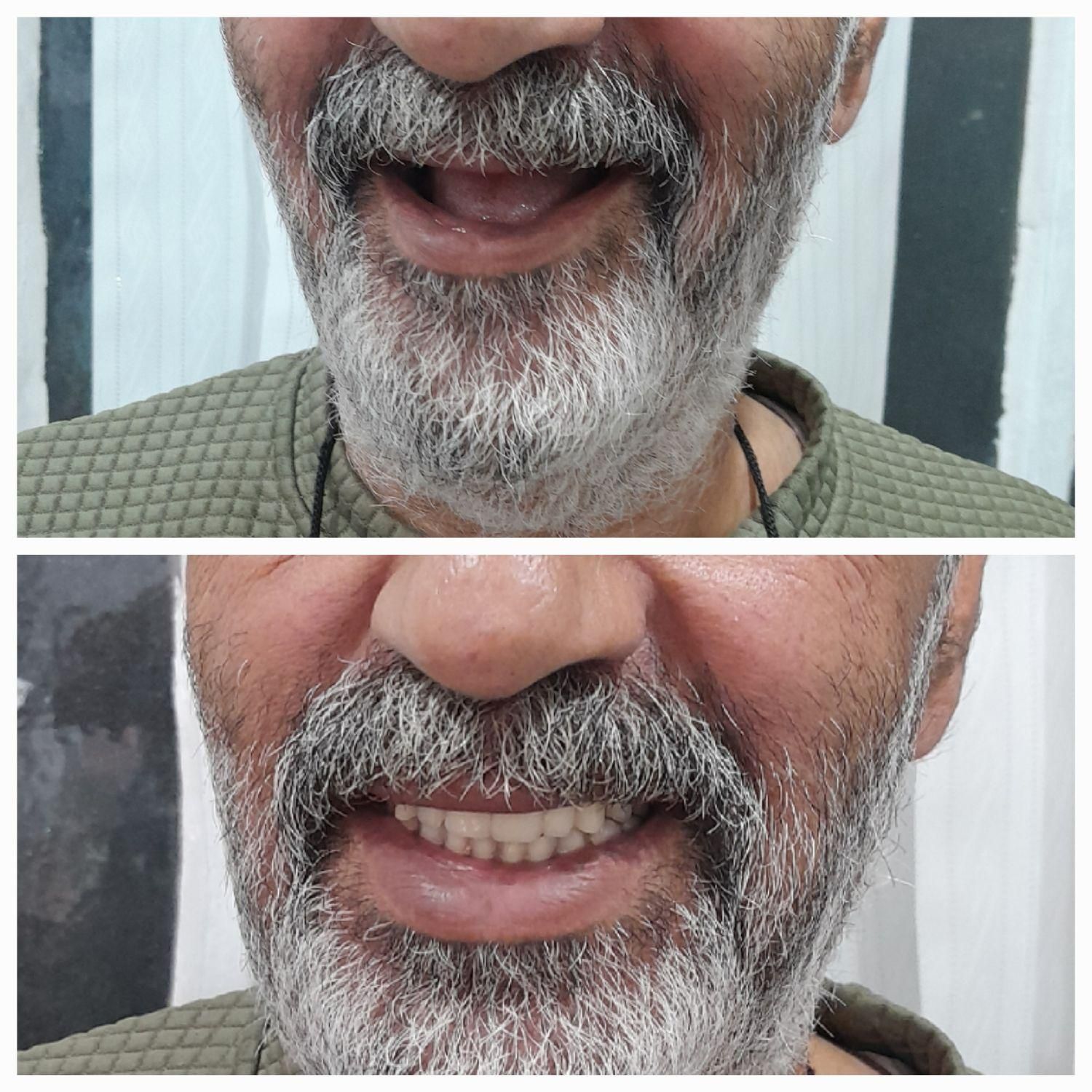 دندان مصنوعی|آرایشی، بهداشتی، درمانی|کاشان, راه آهن کاشان|دیوار