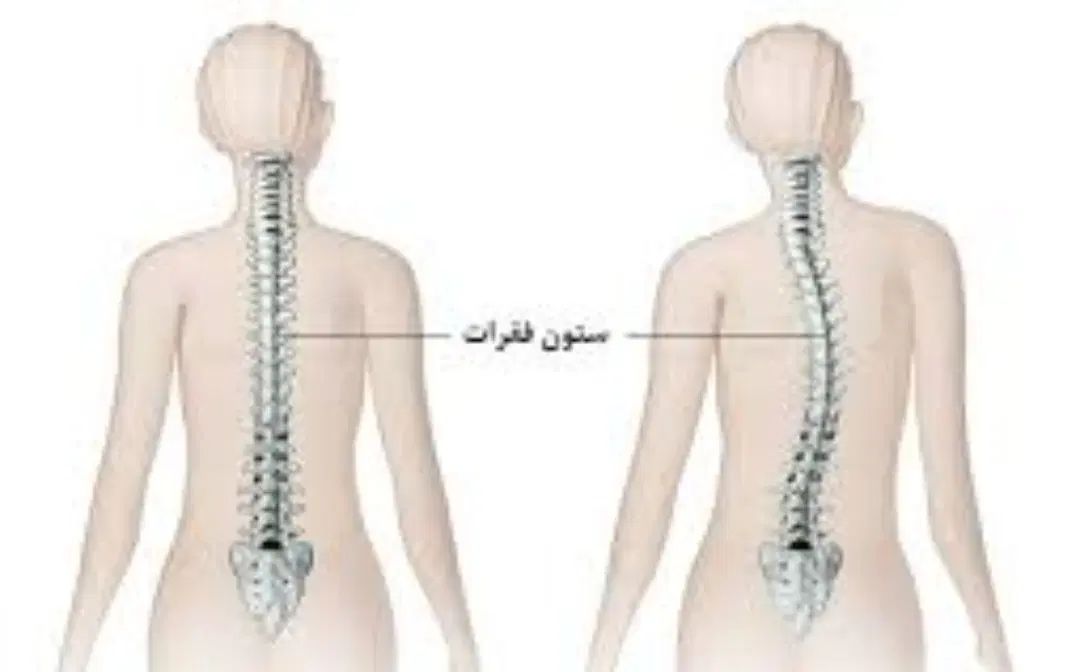 مرکز ارتوپدی درمان غیرجراحی انحراف ستون فقرات|خدمات آرایشگری و زیبایی|ملایر, |دیوار