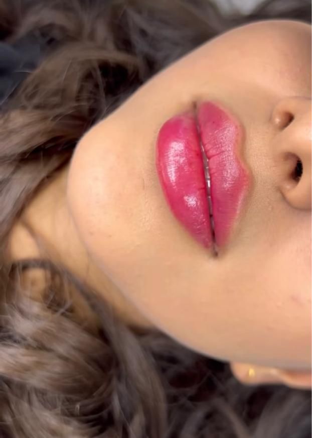 تزریق ژل جشنواره|خدمات آرایشگری و زیبایی|تهران, عبدل‌آباد|دیوار