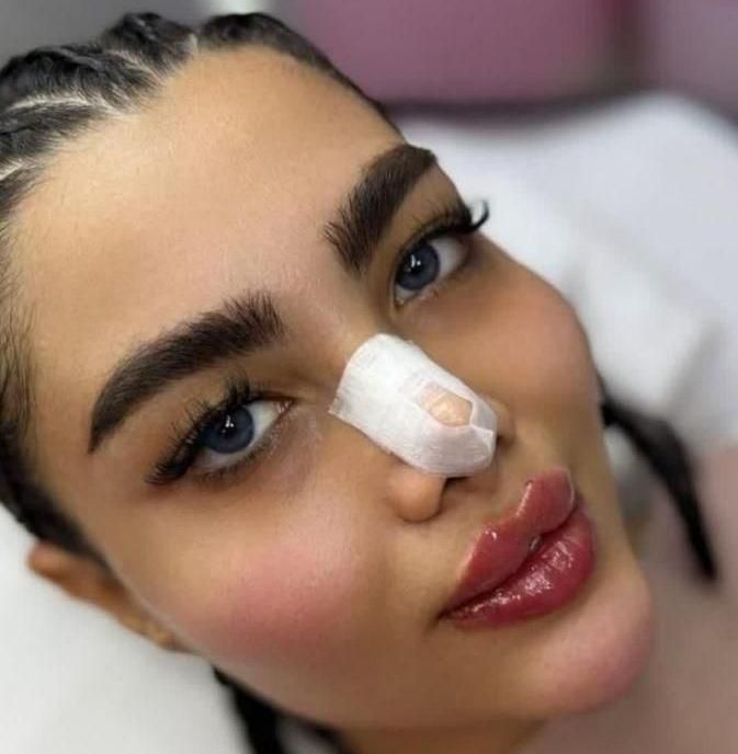 تزریق ژل.بوتاکس.انزیم.چال لپ‌.مزوپیرسینگ|خدمات آرایشگری و زیبایی|فردیس, فردیس|دیوار