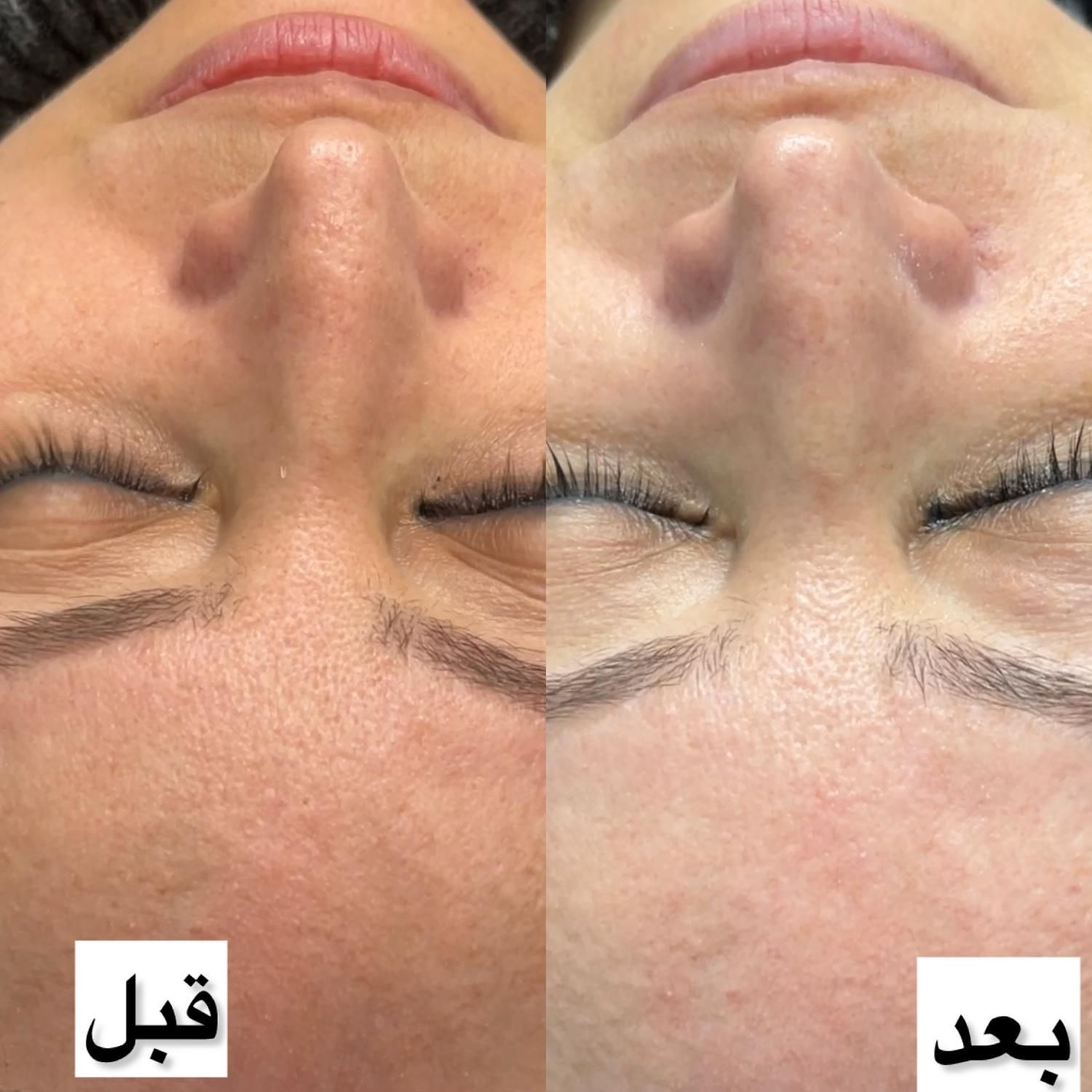 فقط برای 5نفر اول فیشیال ویژه 700|خدمات آرایشگری و زیبایی|شیراز, شهرک والفجر|دیوار