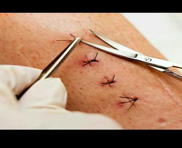 بخیه و تزریقات سرم تراپی و پانسمان در منزل|خدمات آرایشگری و زیبایی|خرم‌آباد, |دیوار