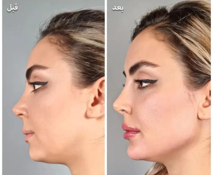 خدمات زیبایی نفس|خدمات آرایشگری و زیبایی|سنندج, |دیوار