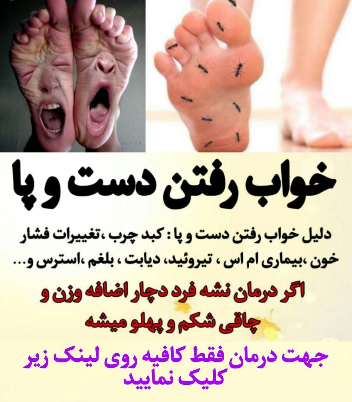 کبد|خدمات آرایشگری و زیبایی|شاهین دژ, |دیوار