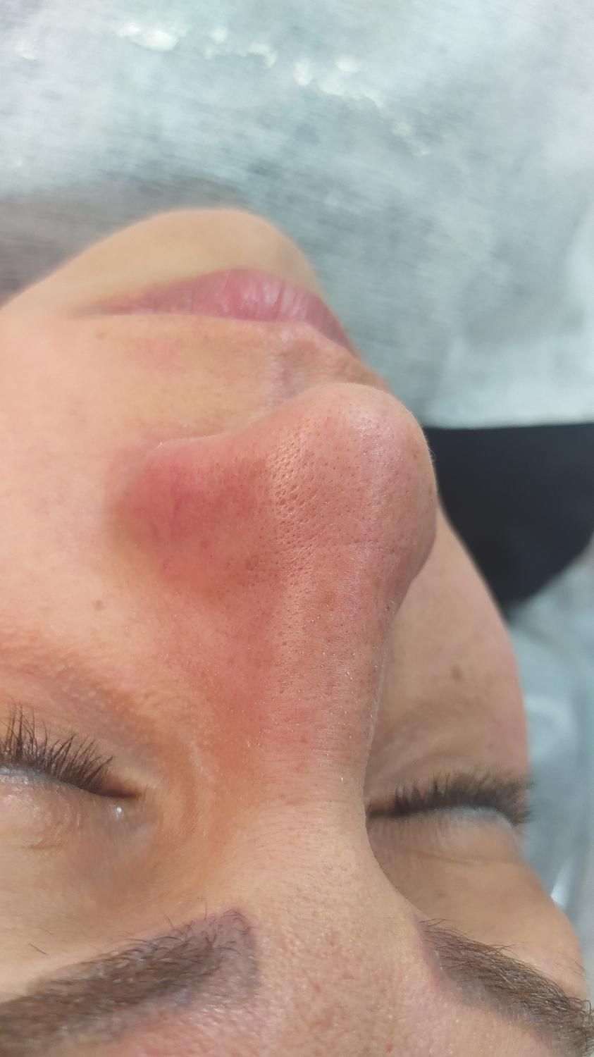 فشیال و پاکسازی تخصصی پوست|خدمات آرایشگری و زیبایی|اصفهان, عسگریه|دیوار