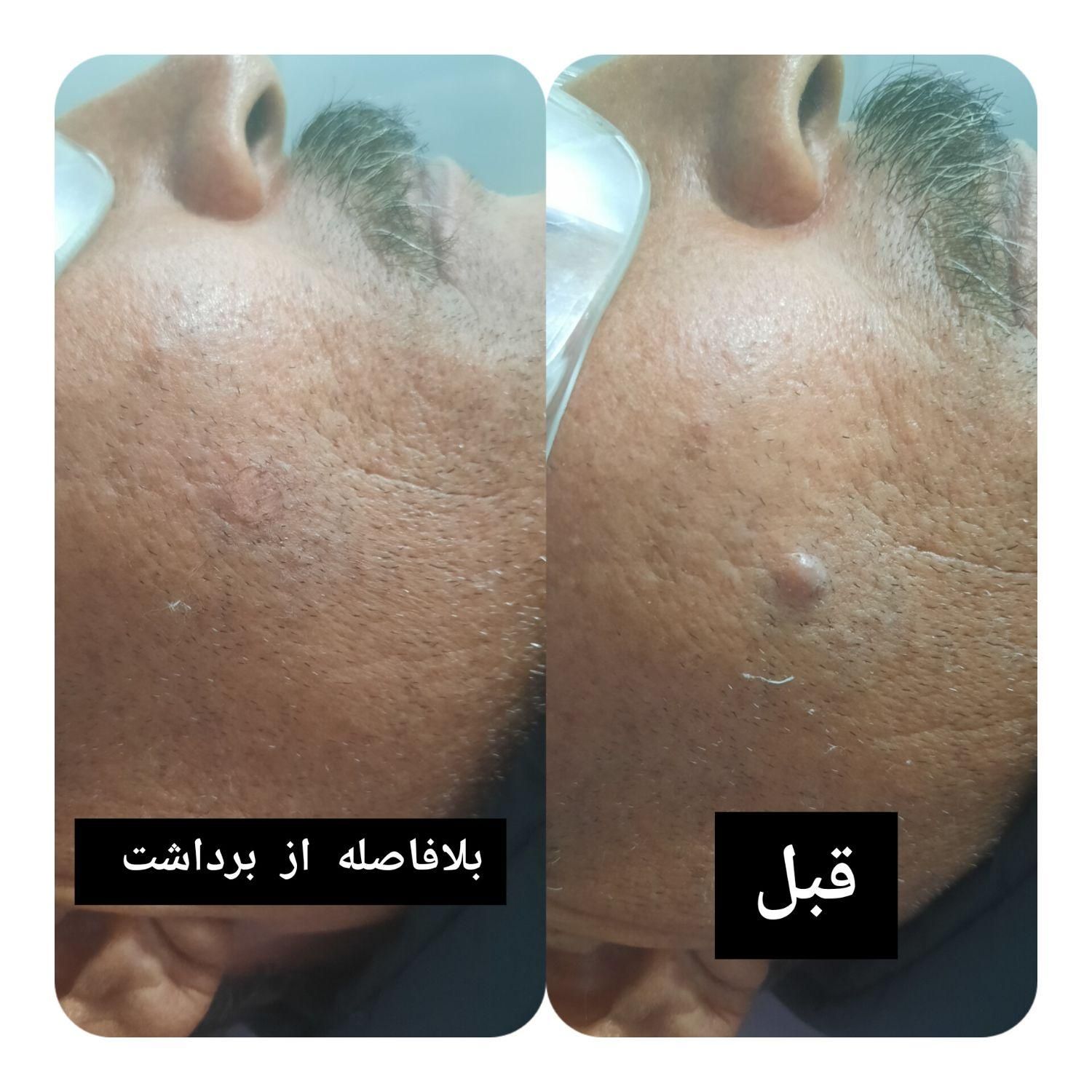 کلینیک لیزر مو ،prp مزو رشدمو،بوتاکس توسط پزشک|خدمات آرایشگری و زیبایی|نجف‌آباد, امام خمینی|دیوار