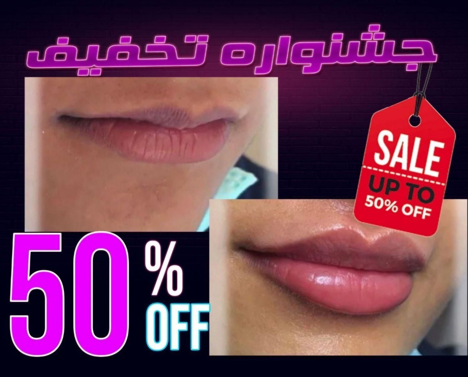 تزریق ژل بوتاکس لیزر هایفو لیفت صورت فیلرلب بیکینی|خدمات آرایشگری و زیبایی|تهران, صادقیه|دیوار