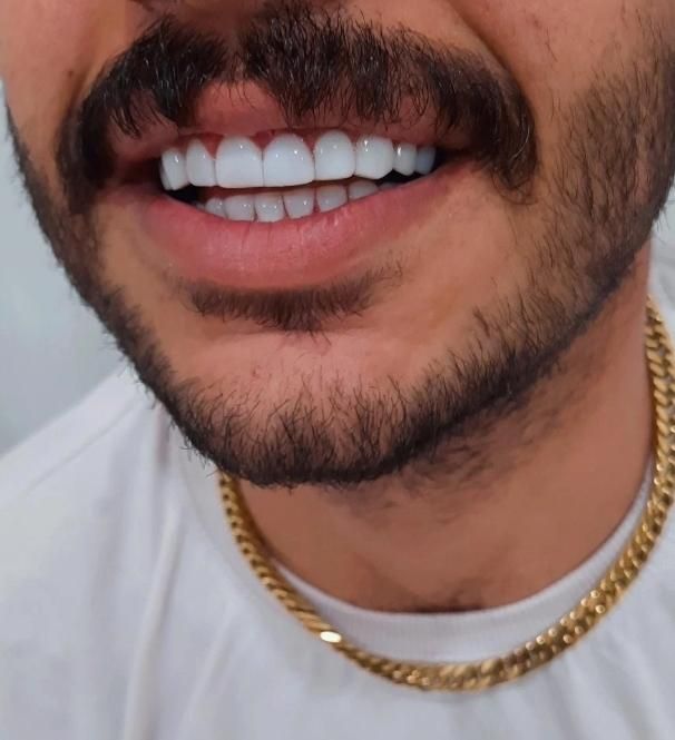 خدمات دندانسازی و دندانپزشکی|خدمات آرایشگری و زیبایی|ارومیه, |دیوار