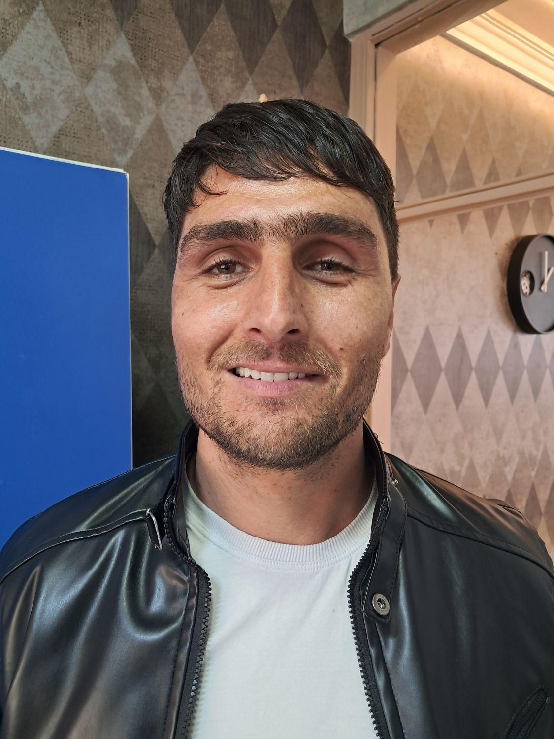 دست دندان مصنوعی طرح لمینت زیبایی تا ۶ ماه اقساط|خدمات آرایشگری و زیبایی|تبریز, |دیوار