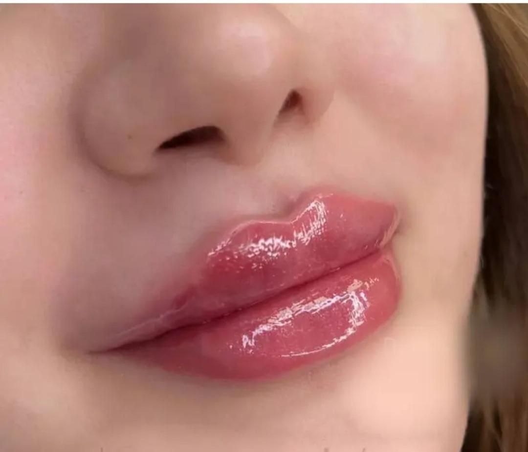 تزریق ژل وفیلر،بوتاکس ،لیزر مطب دکتر دستگیر|خدمات آرایشگری و زیبایی|تبریز, |دیوار