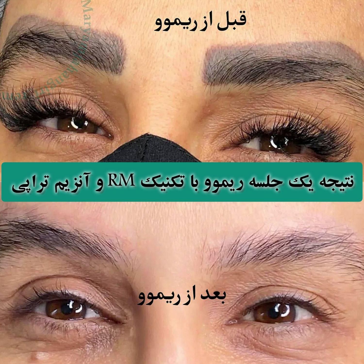 تخفیف ریموو تتو ابرو، خط چشم و لب در مرکز پوست غرب|خدمات آرایشگری و زیبایی|تهران, باغ فیض|دیوار