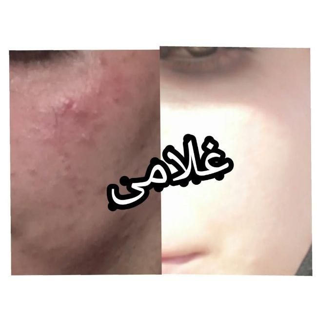 کرم معجزه ونوس لایف غلامی|آرایشی، بهداشتی، درمانی|شیراز, شیخ علی چوپان|دیوار