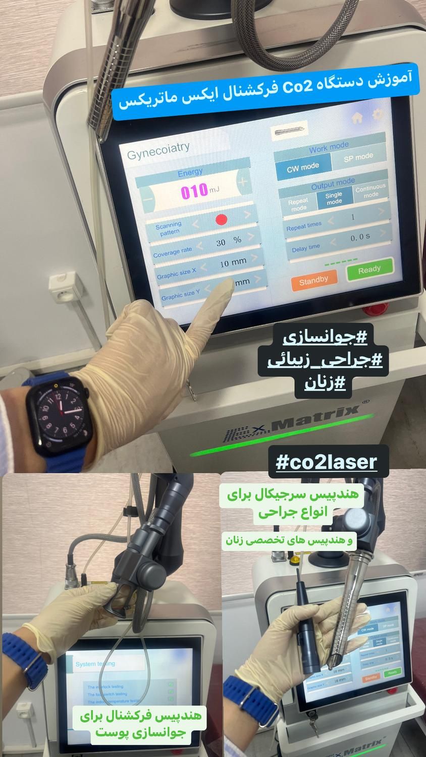 دستگاه co2 فرکشنال ایکس ماتریکس|پزشکی|تهران, فاطمی|دیوار
