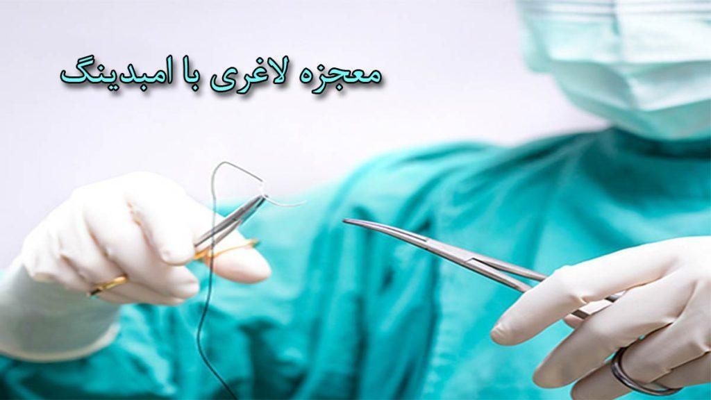 امبیدینگ فقط ۵میلیون وهردستگاه لاغری۱۹۹ هزار تومان|خدمات آرایشگری و زیبایی|اصفهان, باغ نگاره|دیوار