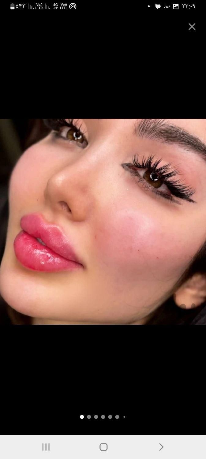 ژل فیلر بوتاکس مزو لیزر هایفو فیشیال خال مطب سلامت|خدمات آرایشگری و زیبایی|تبریز, |دیوار