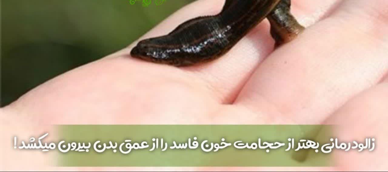گردهمایی حجامت|گردهمایی و همایش|کرج, عظیمیه|دیوار