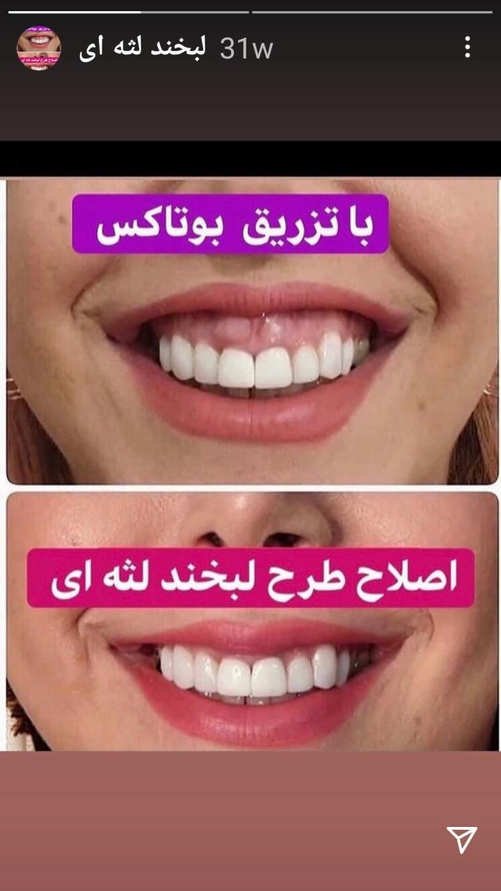 رفع تضمینی تعریق زیر بغل و کف دست|خدمات آرایشگری و زیبایی|تبریز, |دیوار