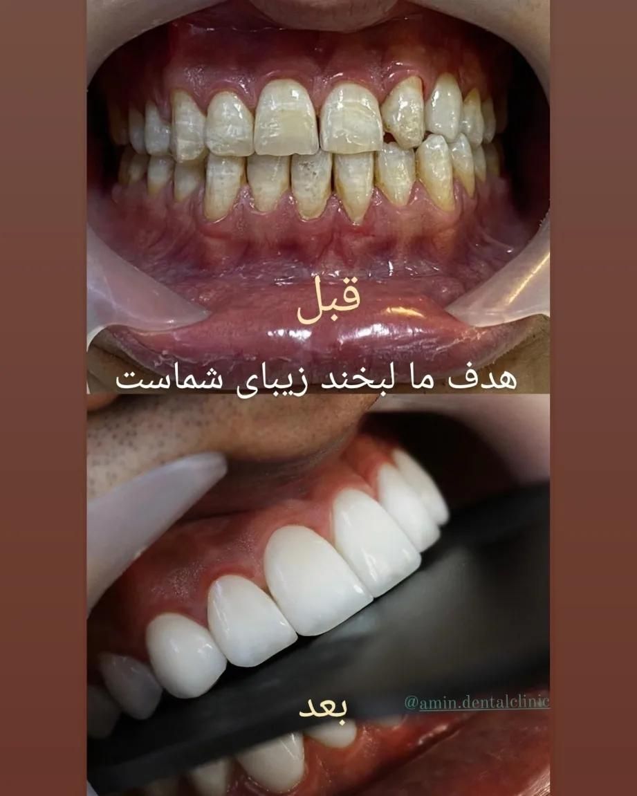 کلینیک تخصصی دندانپزشکی امین|خدمات آرایشگری و زیبایی|مشهد, چهارچشمه|دیوار