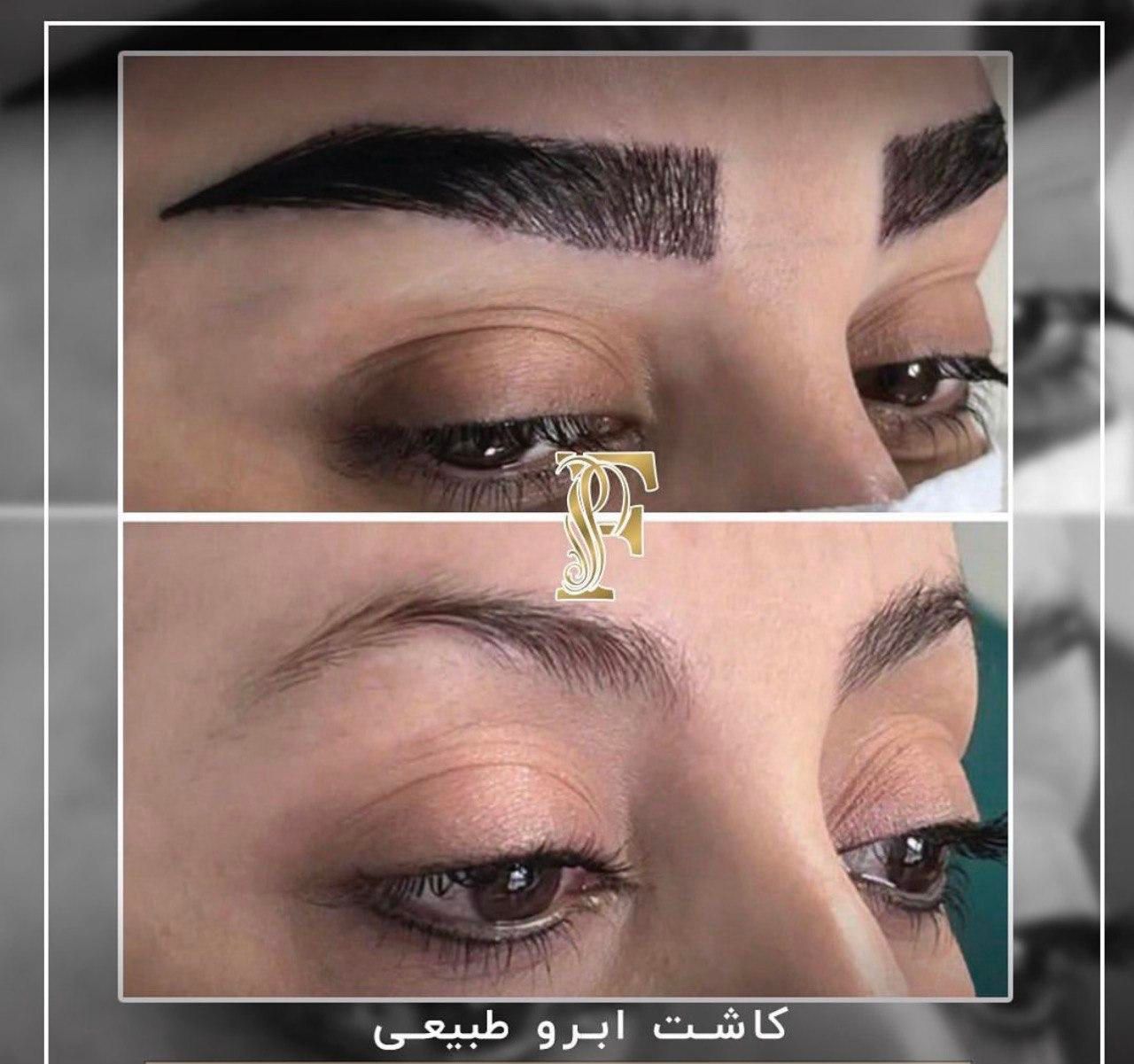 کاشت مو ابرو ریش بدون جراحی با پیشرفته ترین روش|خدمات آرایشگری و زیبایی|تهران, الهیه|دیوار