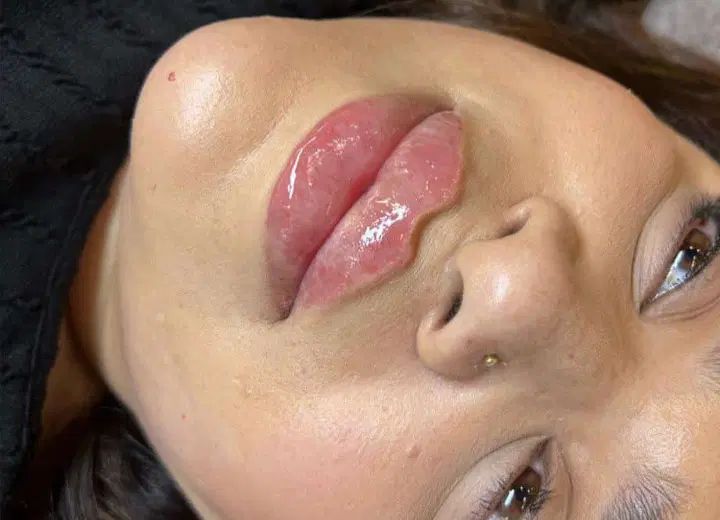 آموزش ژل و بوتاکس/لیفت نخ/لابیاپلاستی/ساکشن غبغب|خدمات آموزشی|تهران, فرمانیه|دیوار