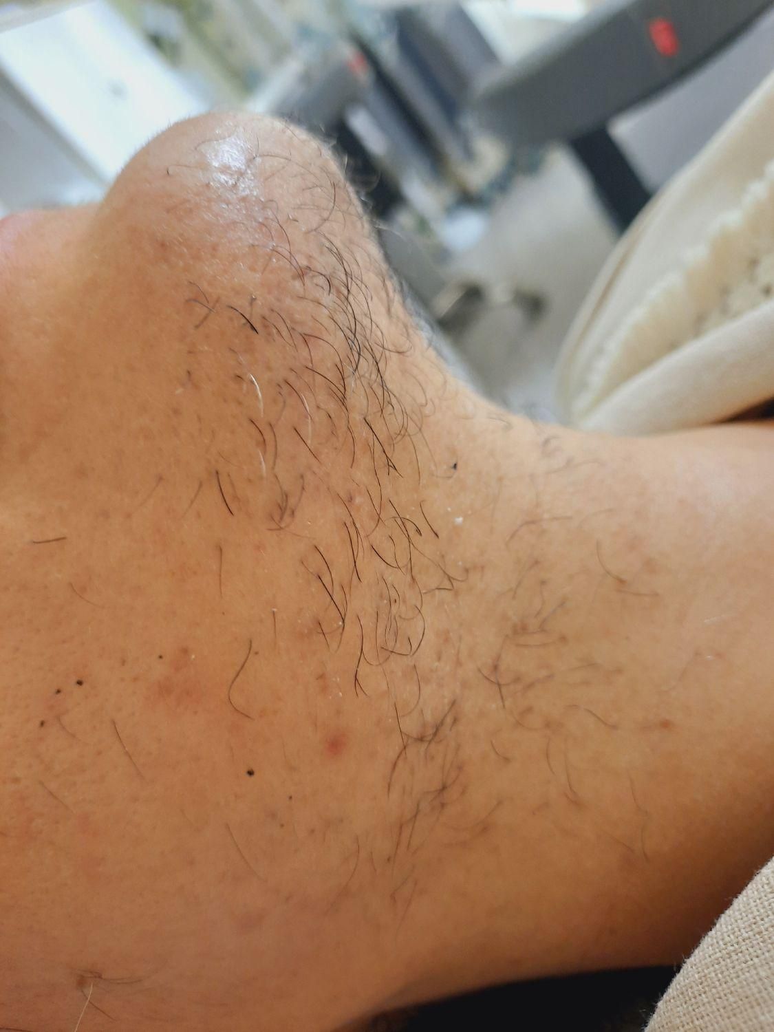 الکترولیز.پیرسینگ.پلاسما.خالبرداری|خدمات آرایشگری و زیبایی|سنندج, |دیوار