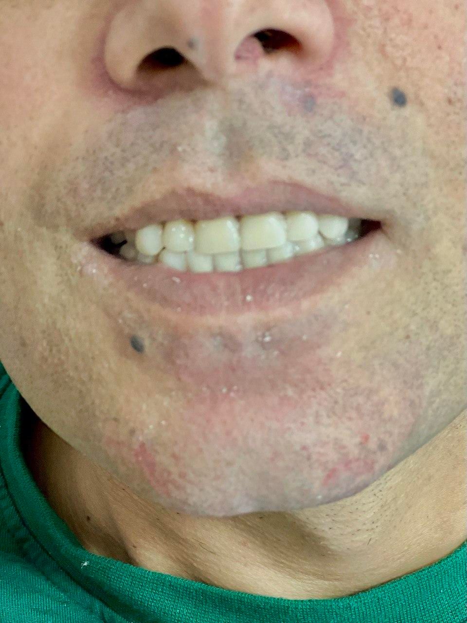 دندان مصنوعی(اقساطی)دندانسازی|خدمات آرایشگری و زیبایی|ارومیه, |دیوار