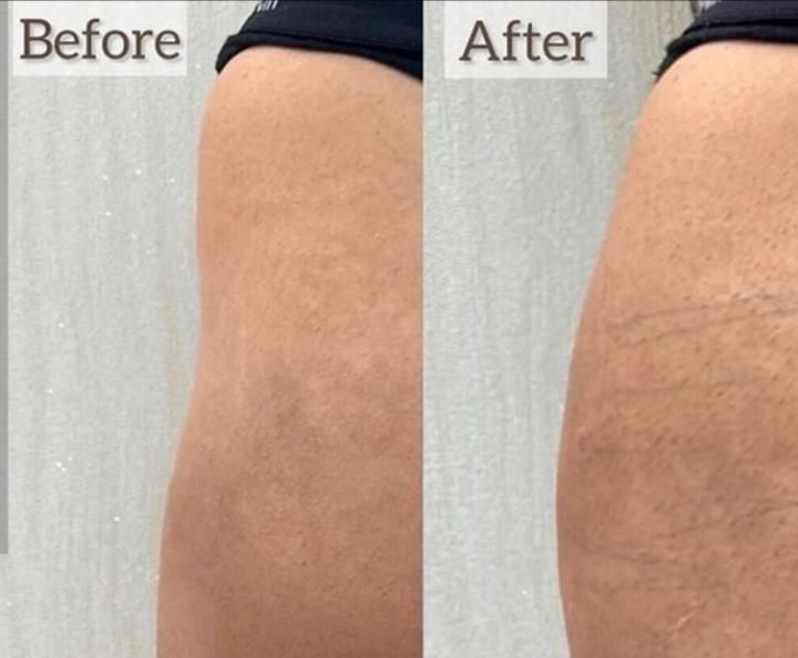 دوره جامع آموزش تزریق ژل،بوتاکس،لیفت نخ وفیلربادی|خدمات آموزشی|شاهین‌شهر, فردوسی|دیوار