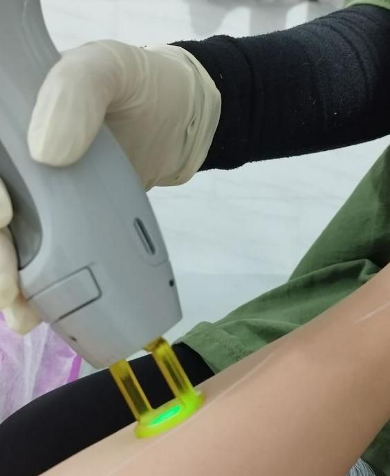 لیزر مو کندلا 2022 (سری شخصی )|خدمات آرایشگری و زیبایی|شوش, |دیوار