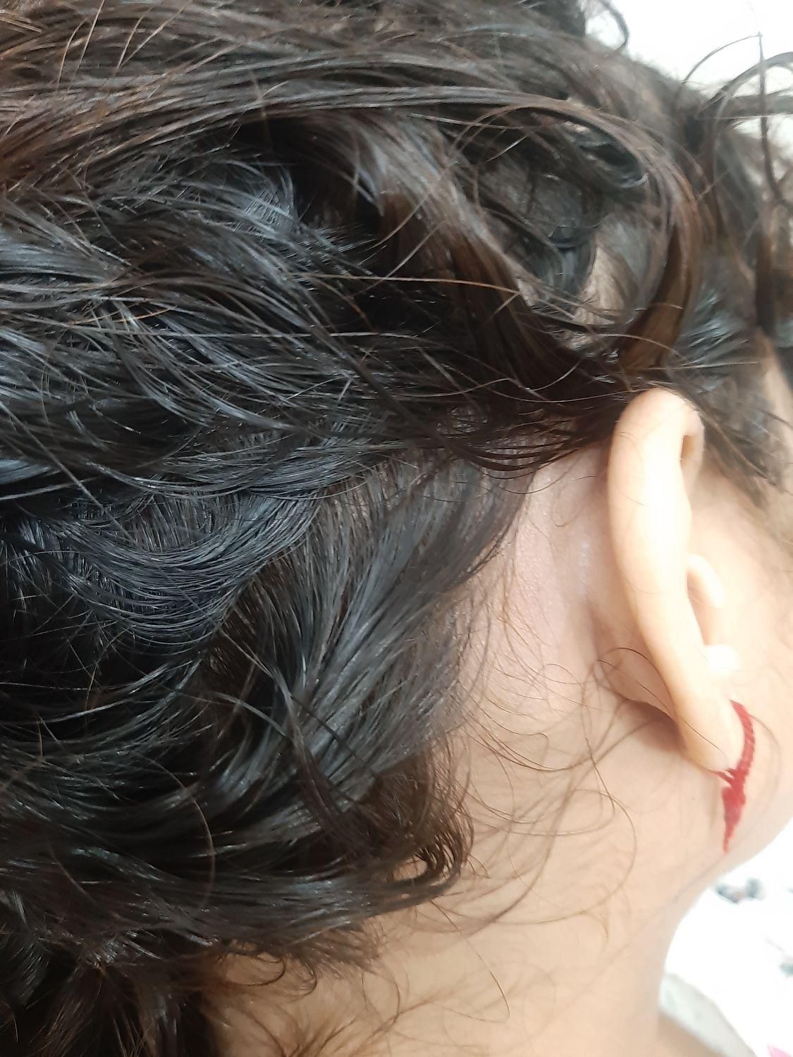 درمان صددرصدگیاهی رشک وشپش|خدمات آرایشگری و زیبایی|گرگان, |دیوار