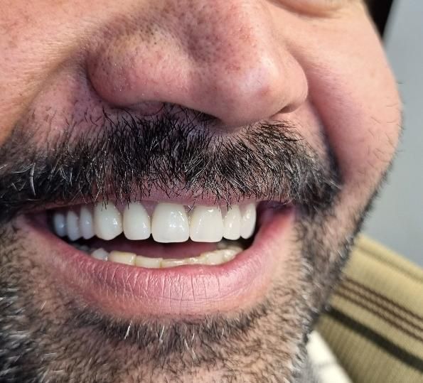 دندانسازی تخصصی (معاینه و مشاوره رایگان)|خدمات آرایشگری و زیبایی|بجنورد, |دیوار