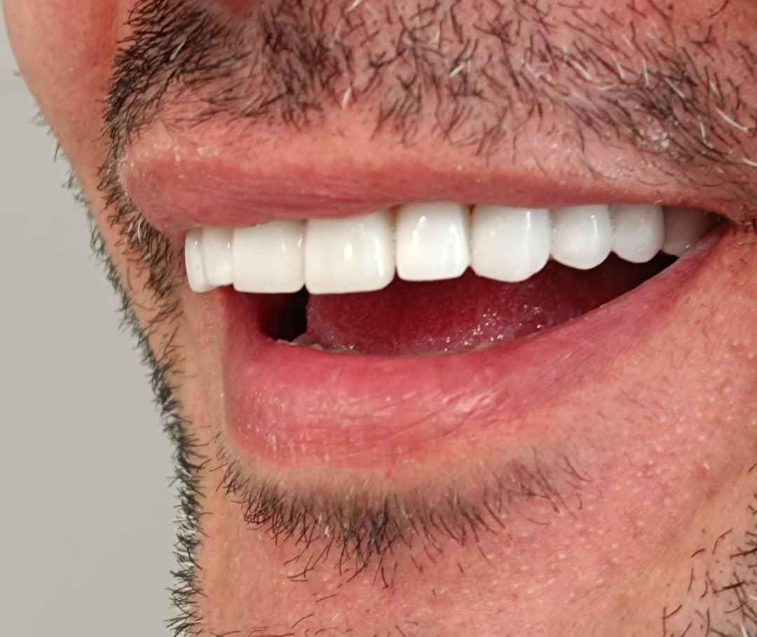 دندانپزشکی نقدواقساط باتخفیفات بینظیر فقط بمدت۷روز|خدمات آرایشگری و زیبایی|شیراز, ملاصدرا|دیوار