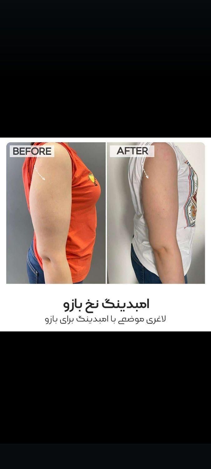 لاغری در سه هفته|خدمات آرایشگری و زیبایی|شیراز, معالی‌آباد|دیوار