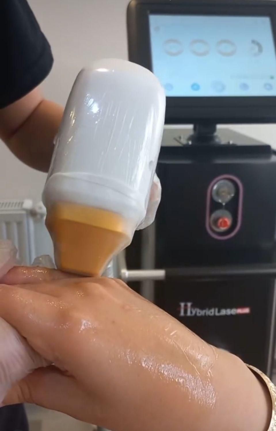 لیزر بانوان و اقایان|خدمات آرایشگری و زیبایی|اردبیل, |دیوار