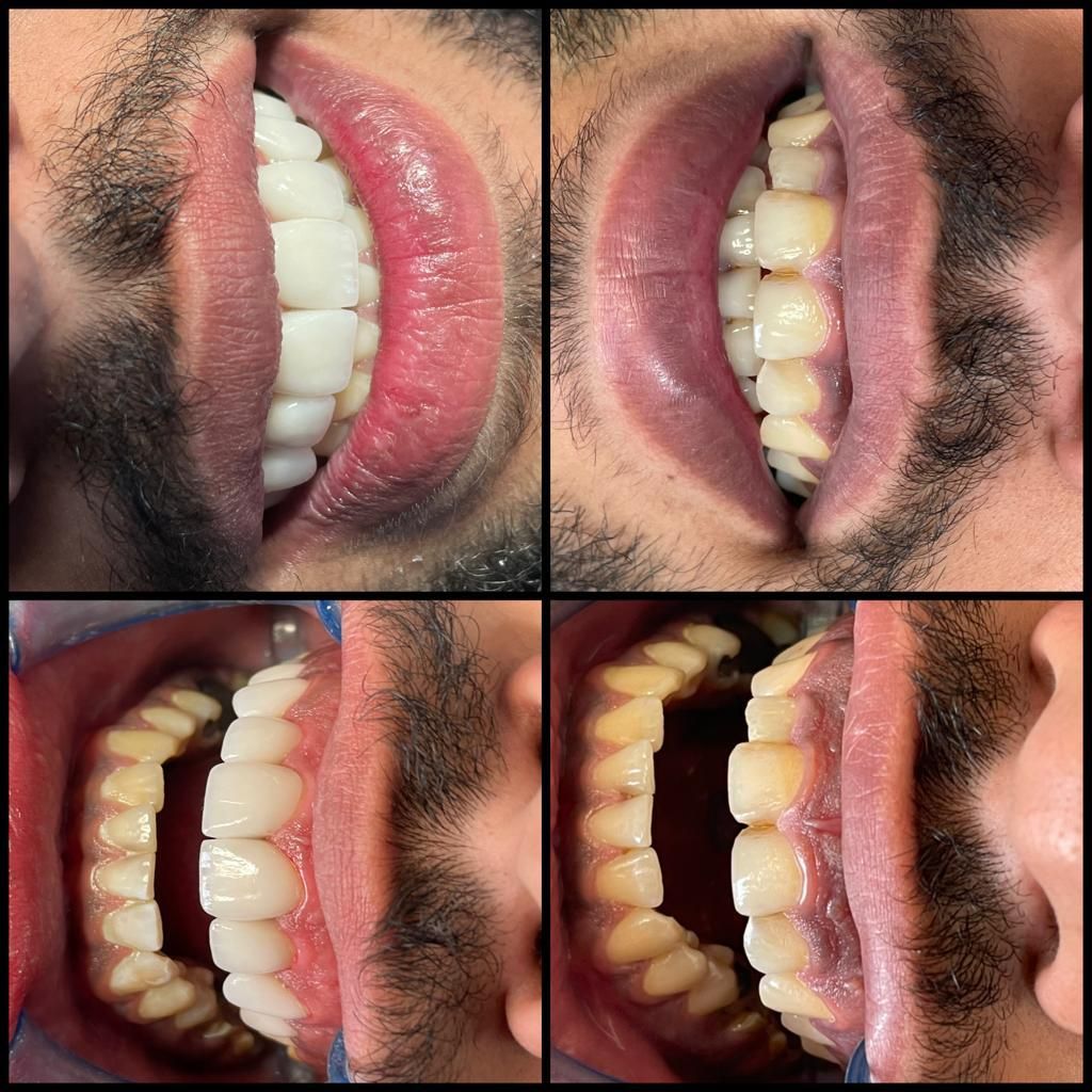 ارتودنسی توسط متخصص،دندانپزشکی اطفال،متخصص زیبایی|خدمات آرایشگری و زیبایی|اصفهان, هفتون|دیوار