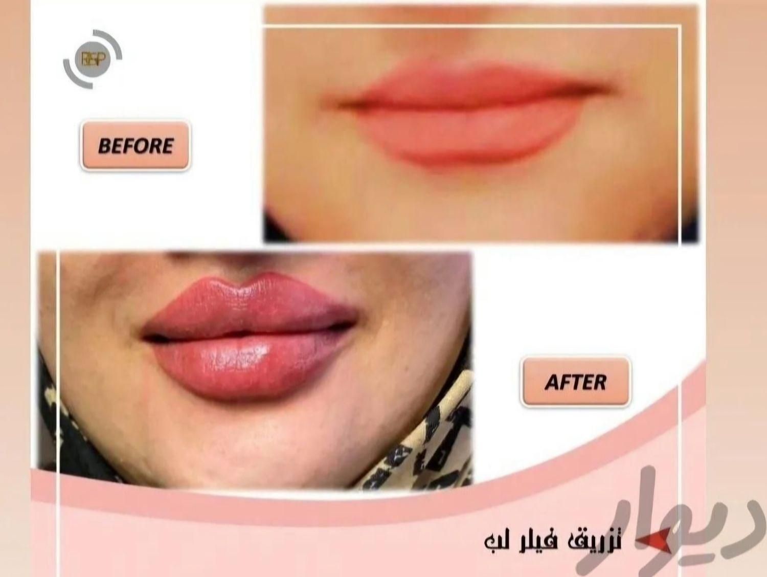 مرکز زیبایی دکتر تقوی|خدمات آرایشگری و زیبایی|یاسوج, |دیوار