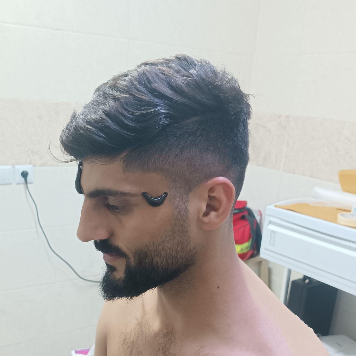 فصد پیشانی ،خالبرداری حجامت ، زالو و بادکش|خدمات آرایشگری و زیبایی|اهواز, کوی مهدیس|دیوار