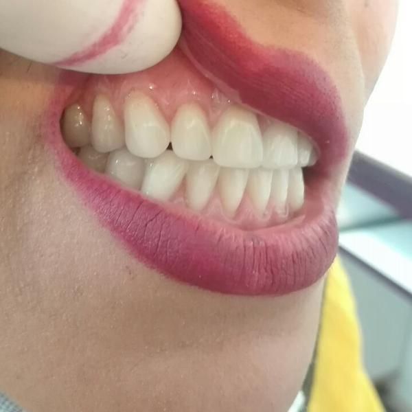 دندانسازی/دندان مصنوعی/بامجوزرسمی و۷۰سال سابقه|خدمات آرایشگری و زیبایی|مشهد, پایین خیابان|دیوار