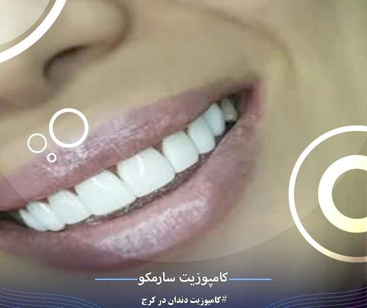 خدمات زیبایی دندان|خدمات آرایشگری و زیبایی|مشکین‌دشت, |دیوار