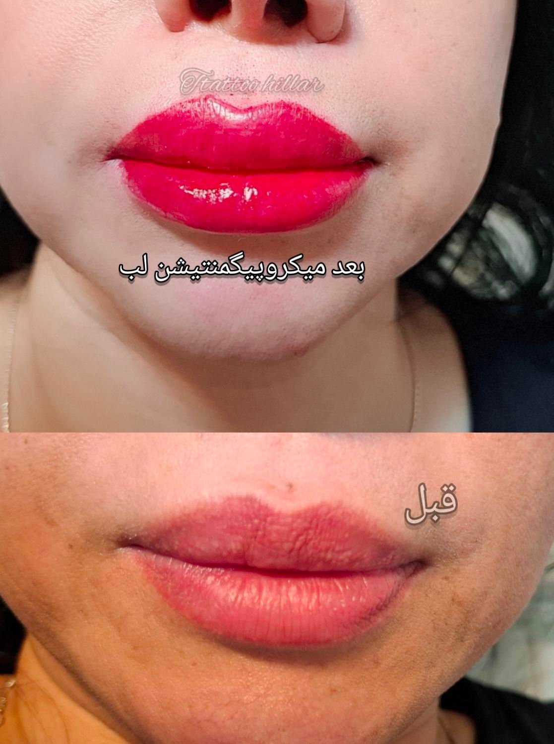 تاتوصورت و بدن و آموزش آرایش ثابت و پاک تتو‌ قدیمی|خدمات آرایشگری و زیبایی|گرگان, |دیوار