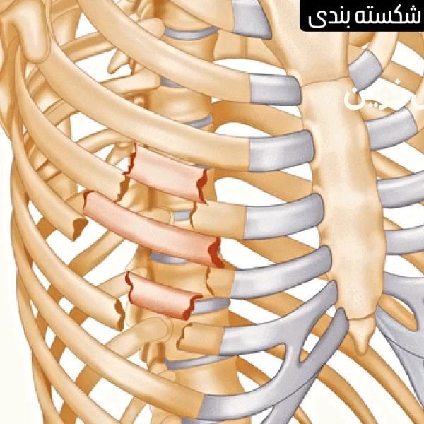 استاد شکسته بندی استخوان در نیشابور|خدمات آرایشگری و زیبایی|نیشابور, رحمت آباد|دیوار
