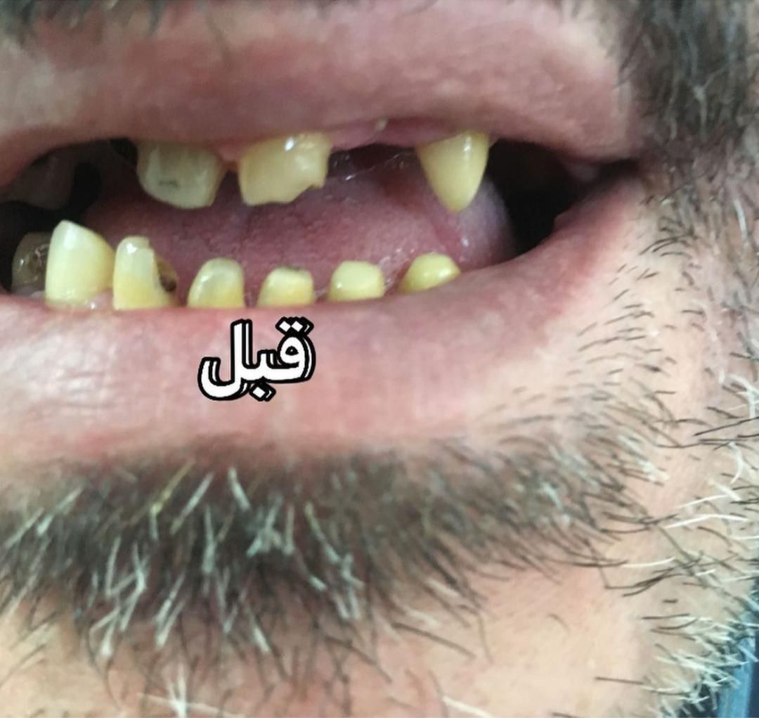 دندانپزشکی و دندان سازی خیریه چمران (جراحی. زیبایی|خدمات آرایشگری و زیبایی|تهران, امام حسین|دیوار