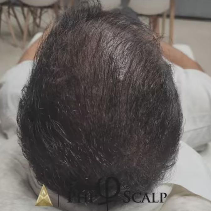 فیبروز آرایش دائم اسکالپ سر ریموو 10 سال سابقه|خدمات آرایشگری و زیبایی|شیراز, فرهنگ شهر|دیوار