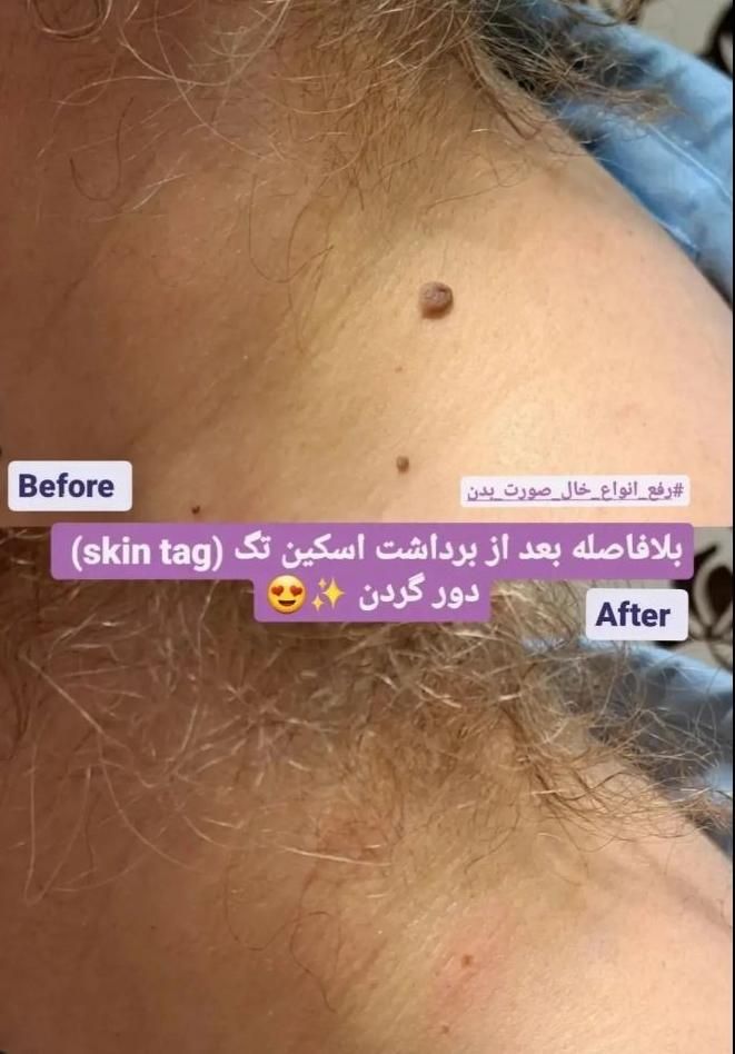 اپیلاسیون دائم،خالبرداری،لیفت ابرو،پارافین تراپی|خدمات آرایشگری و زیبایی|رشت, استقامت 2|دیوار