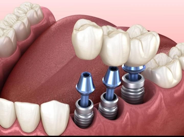 مرکز دندانپزشکی تخصصی|خدمات آرایشگری و زیبایی|اصفهان, عباس‌آباد|دیوار